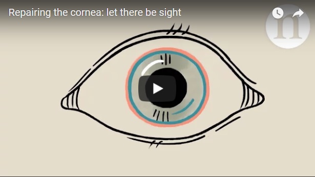 Loss of the stem cells that constantly renew the surface of the cornea causes pain and, in some cases, blindness. Advances in transplantation and cell culture are helping to restore vision to even the most severely affected people.