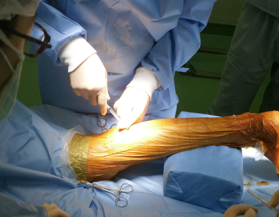 Patients recover limb function after receiving injections of their own stem cells.
