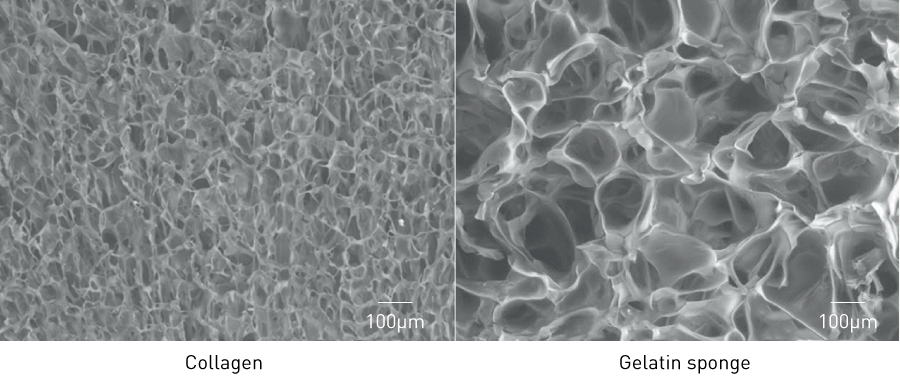 Figure 4. Difference in density between collagen and gelatin sponge (electron micrographs).