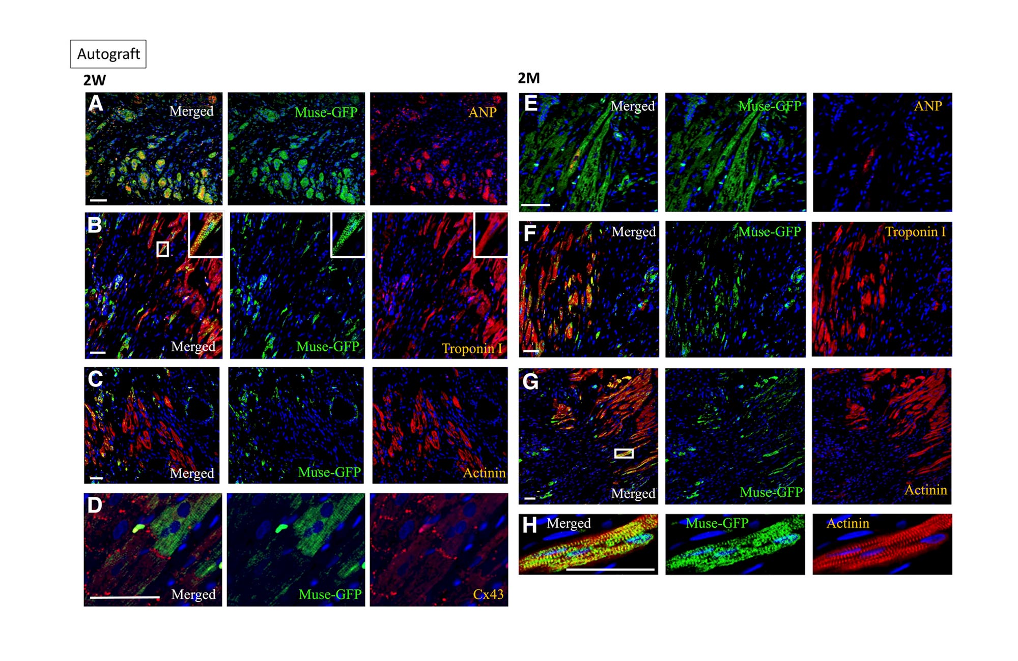 Figure 4. A–D, GFP-labelled autograft Muse cells engrafted into the infarcted myocardial region expressed cardiac markers ANP, troponin I and α-actinin (2 weeks after AMI). GFP-labelled Muse cells also expressed connexin-43 between themselves and host cardiomyocytes (2 weeks after AMI). E–H, GFP-labelled autograft Muse cells engrafted into the infarct myocardial region expressed cardiac markers ANP, troponin I and α-actinin (2 months after AMI). AMI, acute myocardial infarction; ANP, atrial natriuretic peptide; GFP, green fluorescent protein. [Reproduced from Ref. 19]