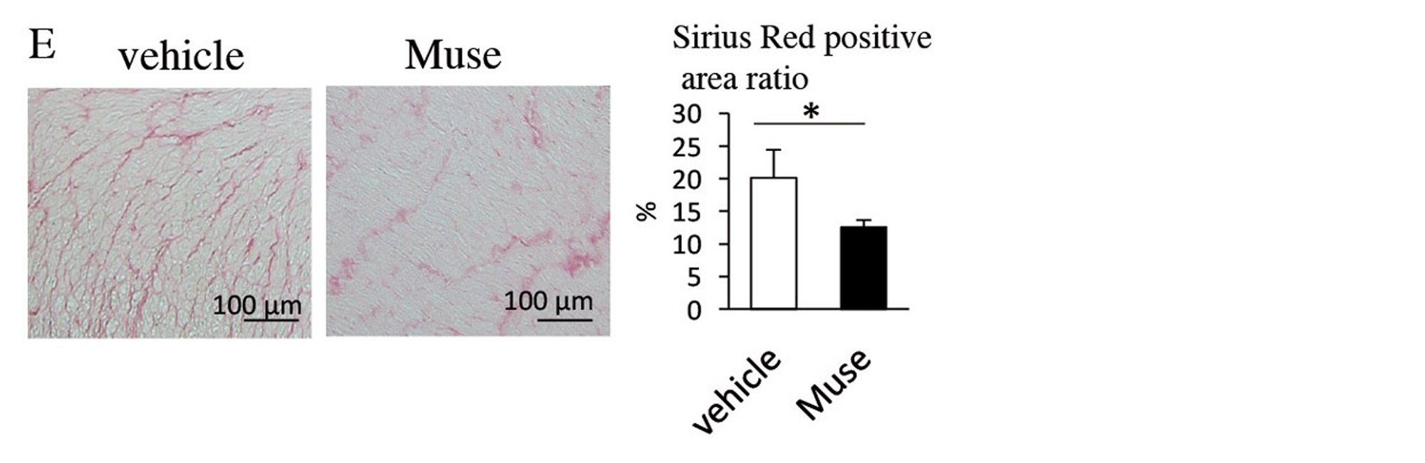 Figure 5. E, Comparison of areas of the Sirius Red-positive region in the infarct regions (vehicle and Muse groups). * p < 0.05; ** p < 0.01; *** p < 0.001; αSMA, α-smooth muscle actin; AMI, acute myocardial infarction; GFP, green fluorescent protein; HGF, hepatocyte growth factor; MMP, matrix metalloproteinase; MSC, mesenchymal stem cell; TUNEL, terminal deoxynucleotidyl transferase dUTP nick-end labelling; VEGF, vascular endothelial growth factor.