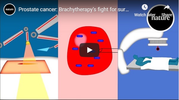 Brachytherapy has a robust track record as a treatment for prostate cancer. The technique involves positioning radioactive materials inside the prostate to kill the tumour.