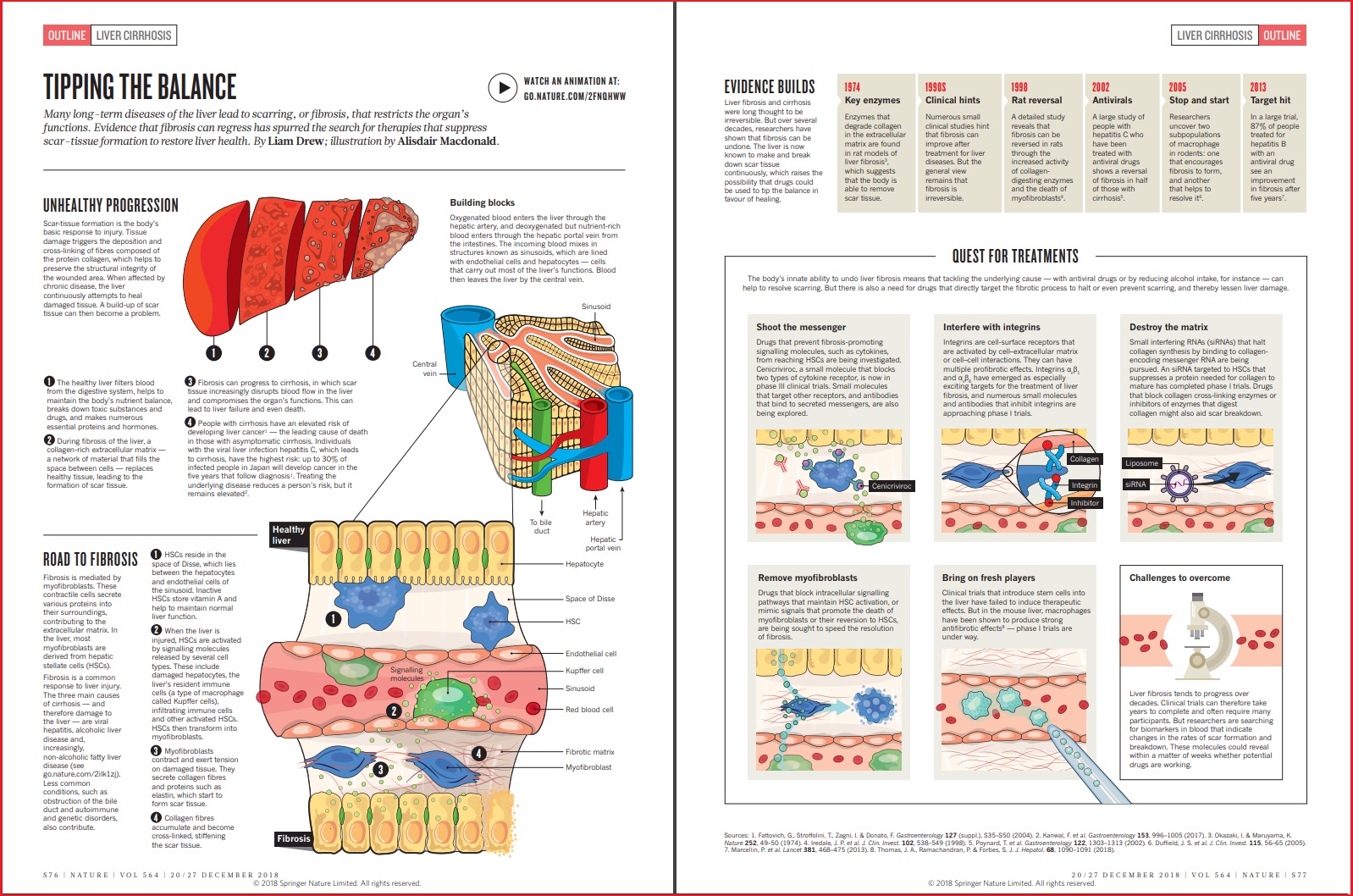 Infographic Liver cirrhosis TRI Advances