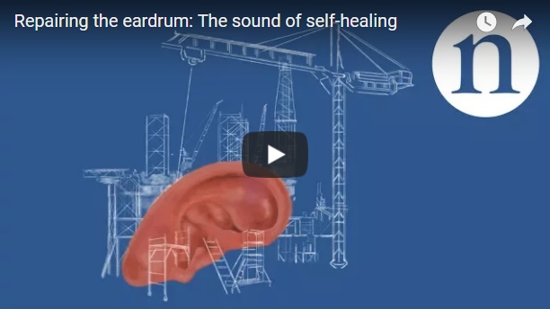 In the most severe cases, a ruptured eardrum can require surgery to put it right, but tissue-engineering techniques might provide a much simpler solution.